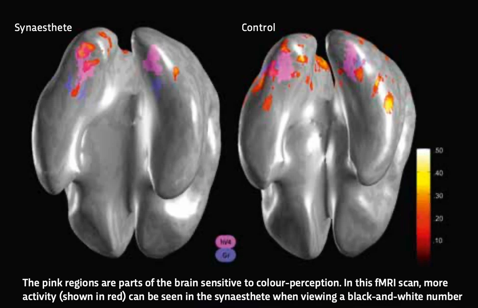 What is synaesthesia?